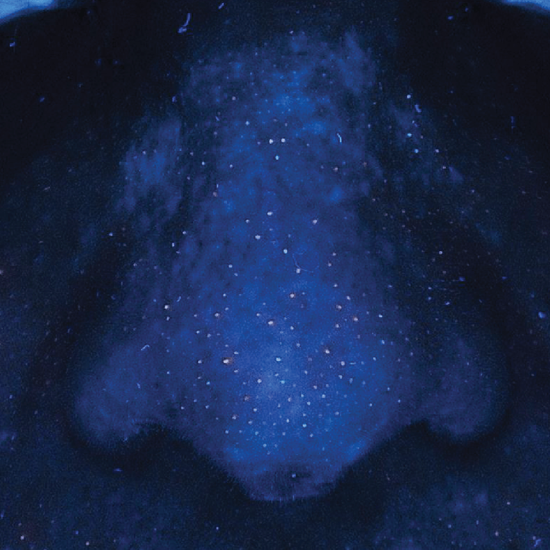 Serum before 1 Serum before 1